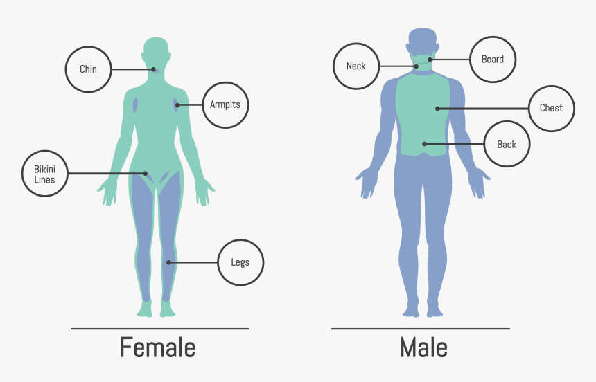 Laser Hair Removal Body Map, HD Png Download