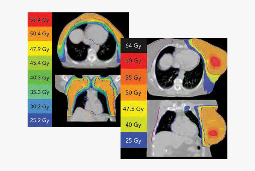 Breast Imrt - Dog Licks, HD Png Download