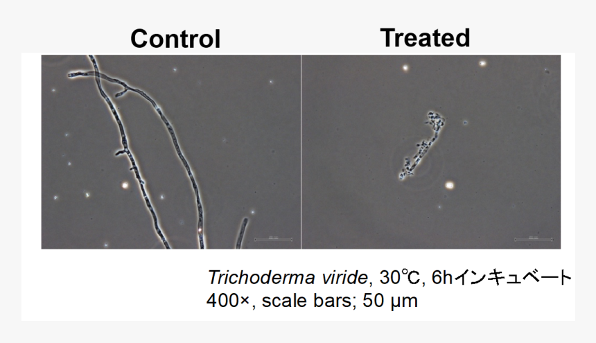 Scale Bar Is 50 Μm - Pest, HD Png Download