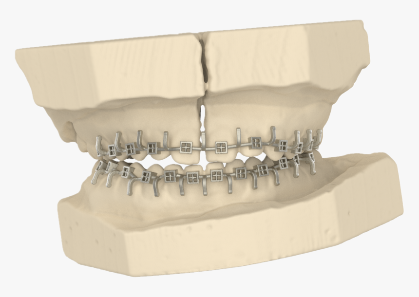 3d Printed Arch Bar - Scale Model, HD Png Download