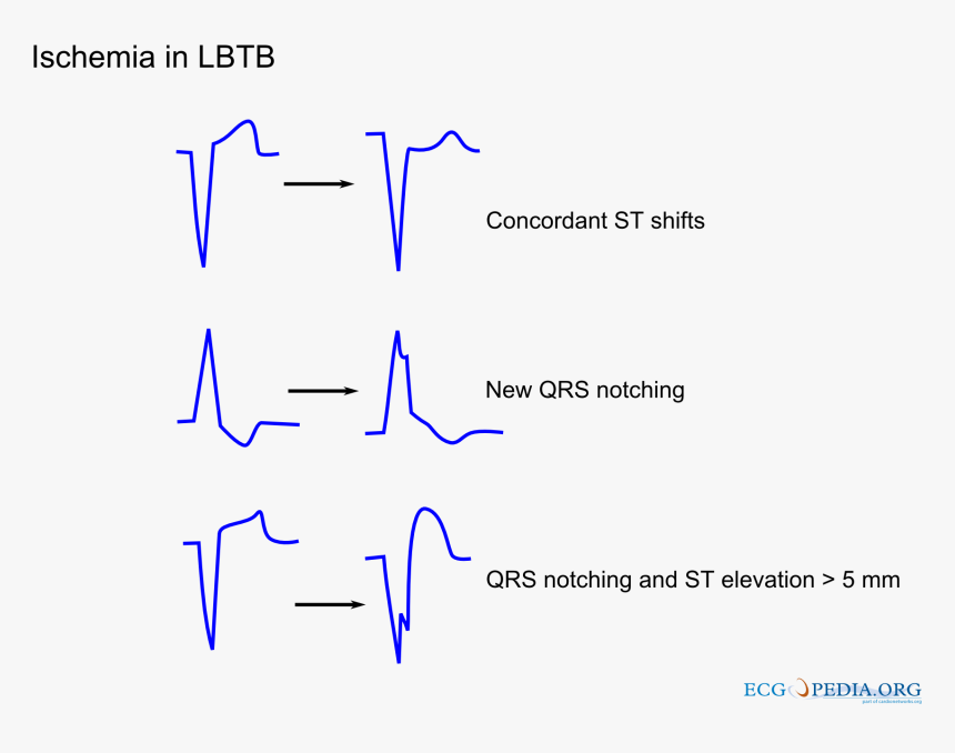 Diagram, HD Png Download
