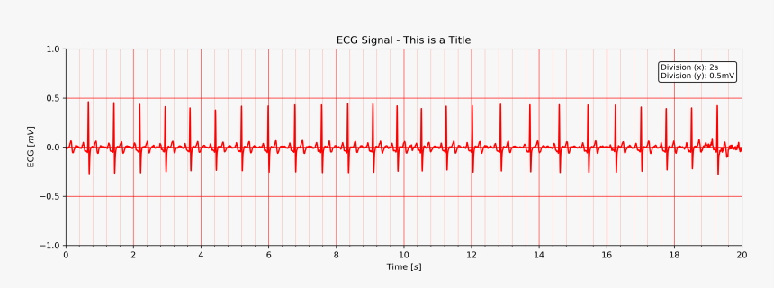 - - / - - / Images/ecg20title - Plot, HD Png Download