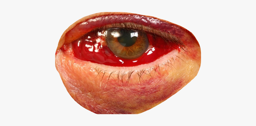 #eye #bloodshot #blood #redeye #bloodshoteyes #face#freetoedit - Transparent Blood Shot Eyes, HD Png Download