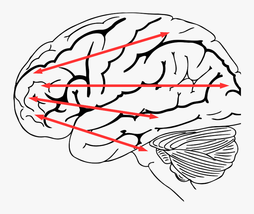 Brain On Lack Of Sleep, HD Png Download