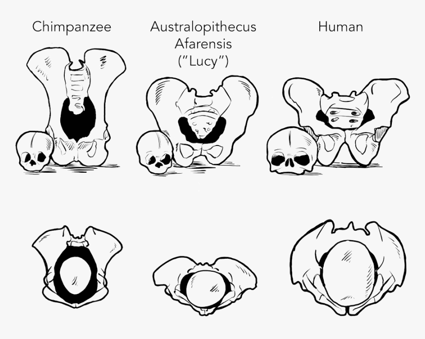 The Relative Sizes Of Female Pelvises And Infant Heads - Cartoon, HD Png Download