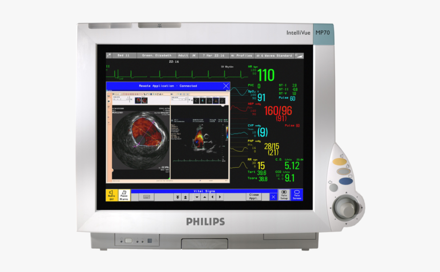 Philips Intellivue Mp70 Patient Monitor, HD Png Download
