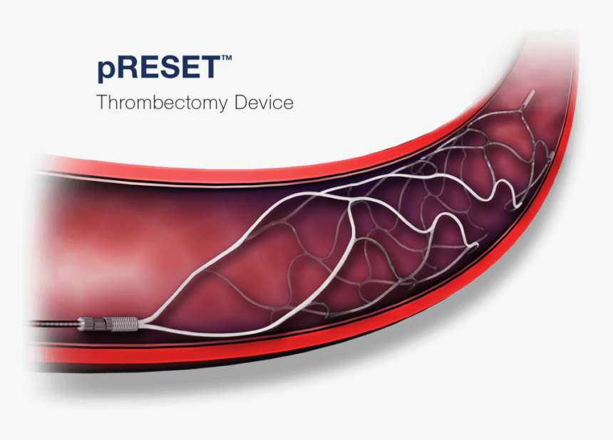 Phenox-preset Thrombectomy Device, HD Png Download