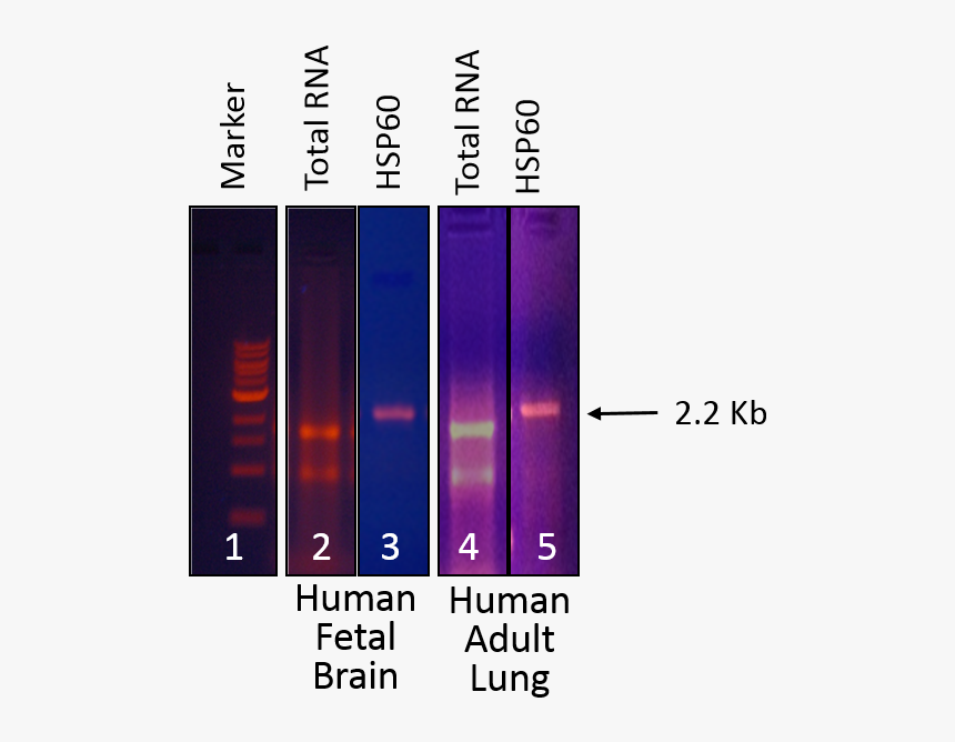 Statistical Graphics, HD Png Download
