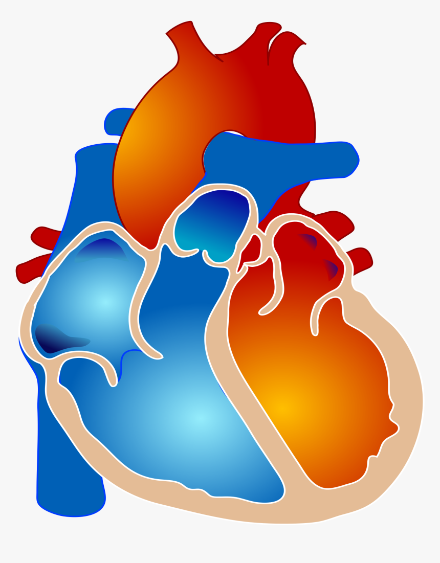 Pulmonary Atresia With Single Ventricle Clipart , Png - Tetralogy Of Fallot, Transparent Png
