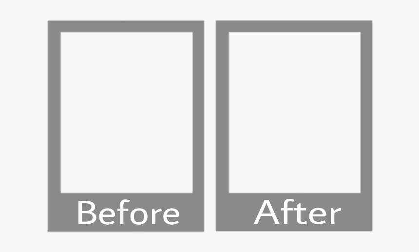 frames before after Before After Photo Frame Png, Transparent Png , Transparent Png Image