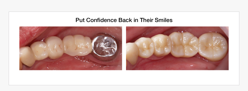 Dentistry, HD Png Download