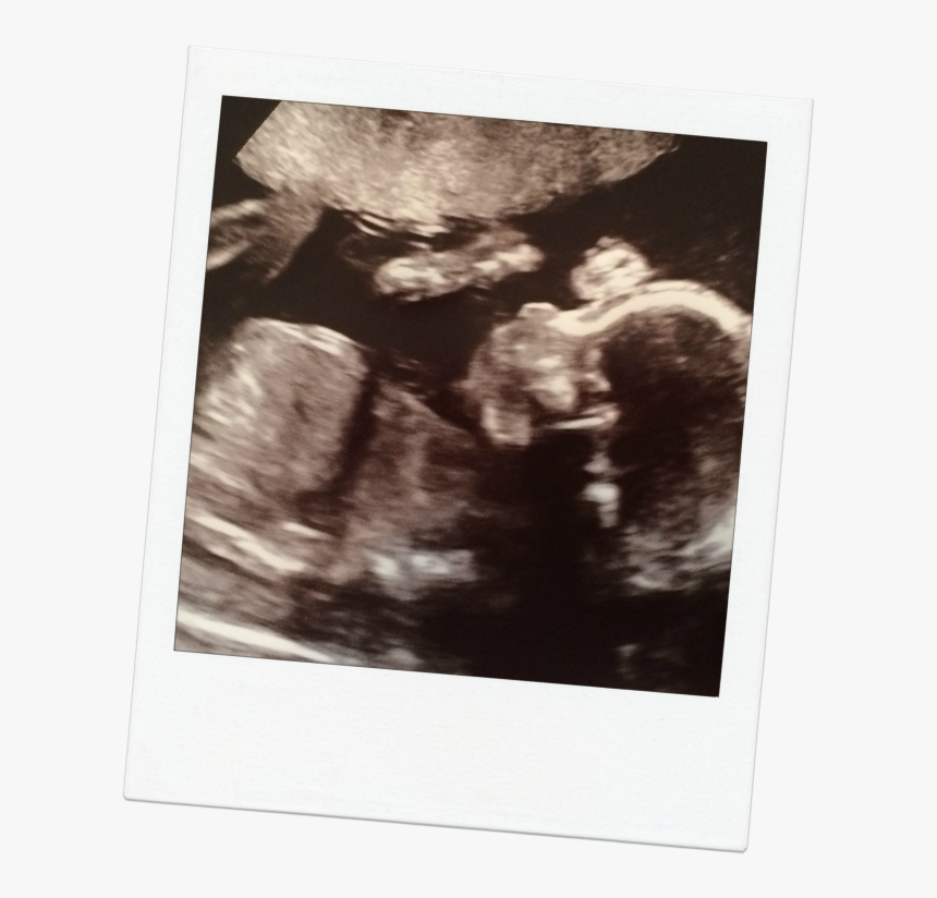 Photograph, HD Png Download