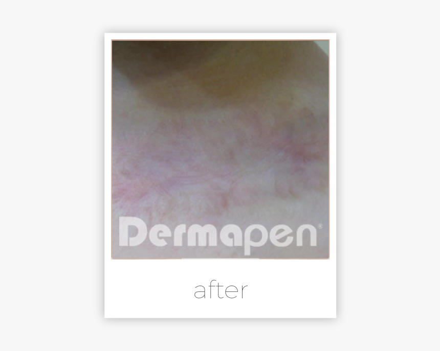 Art, HD Png Download