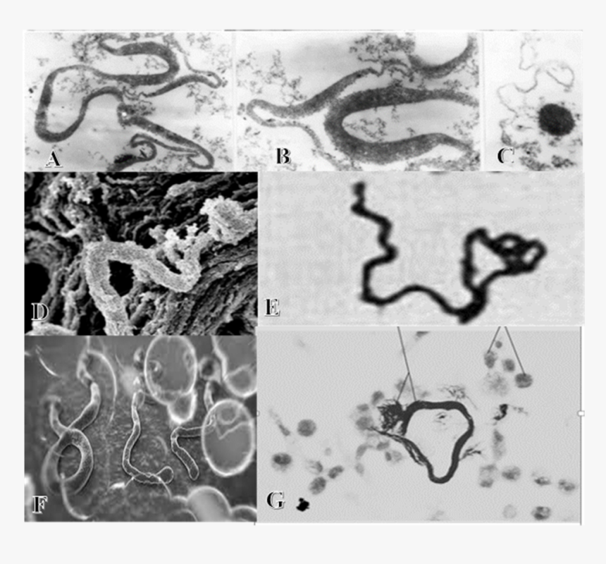 Figures 5a Through 5g - Tb Virus Microscope, HD Png Download