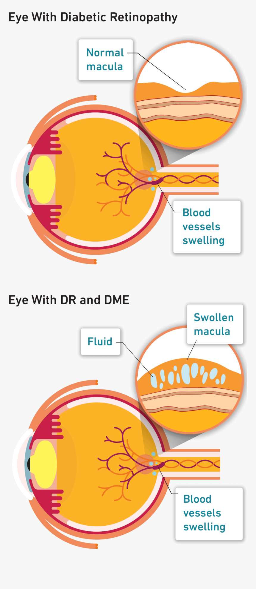 Graphics, HD Png Download