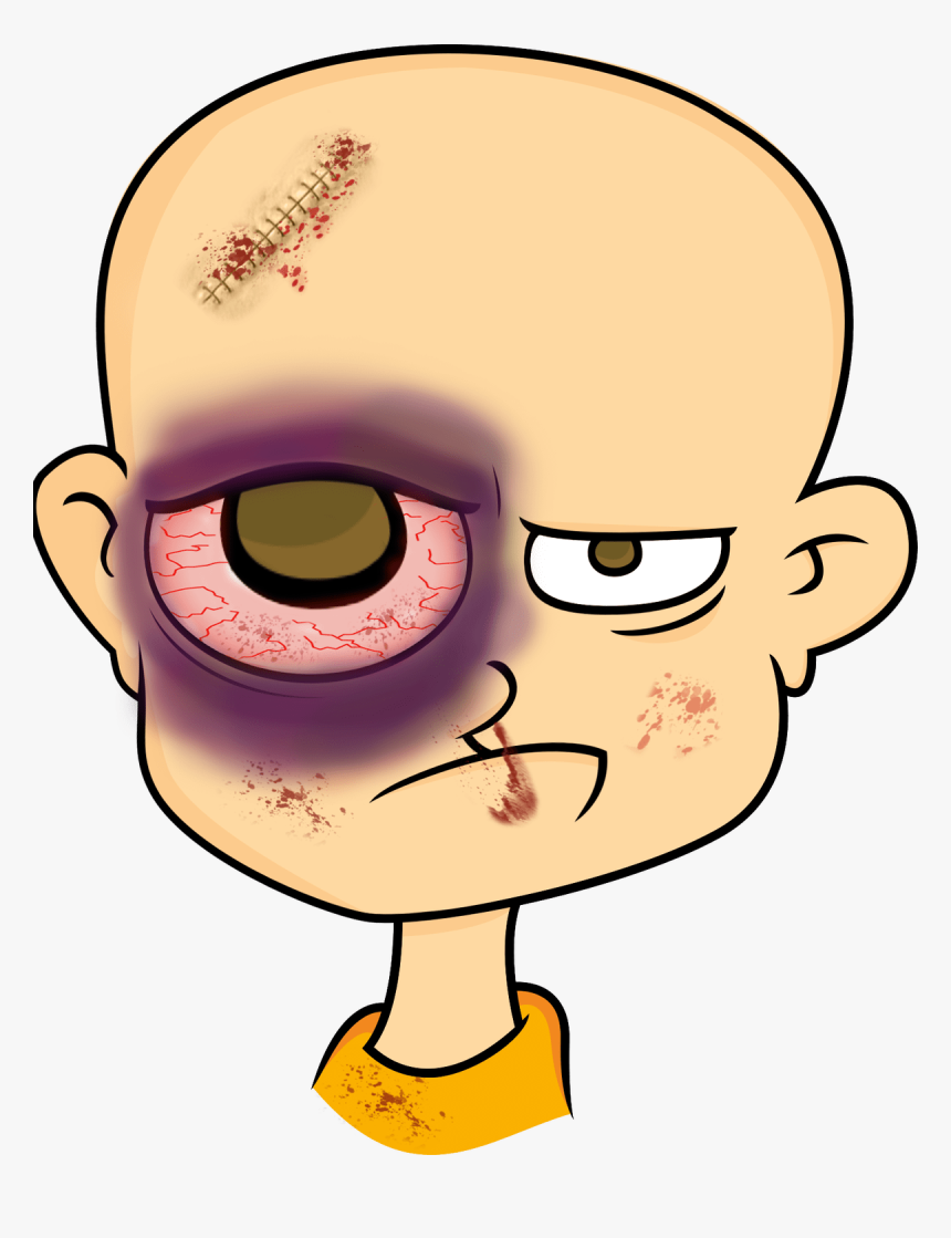 Eyebrow Clipart Eyelid - Clipart Cartoon Black Eye, HD Png Download