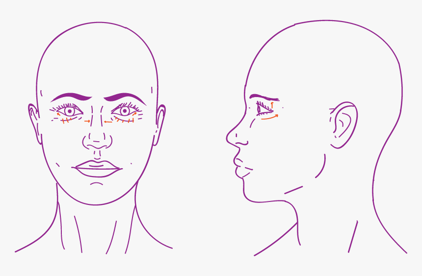 Blepharoplasty Eyelid Surgery In Ffs - Temple Area Of Face, HD Png Download