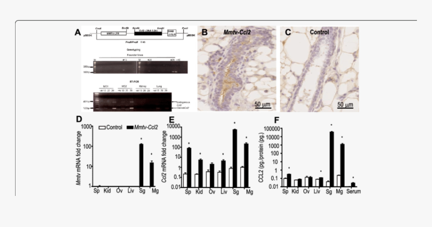 Ccl2 Expression In Cancer, HD Png Download