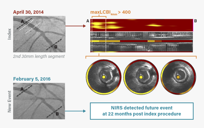 Circle, HD Png Download