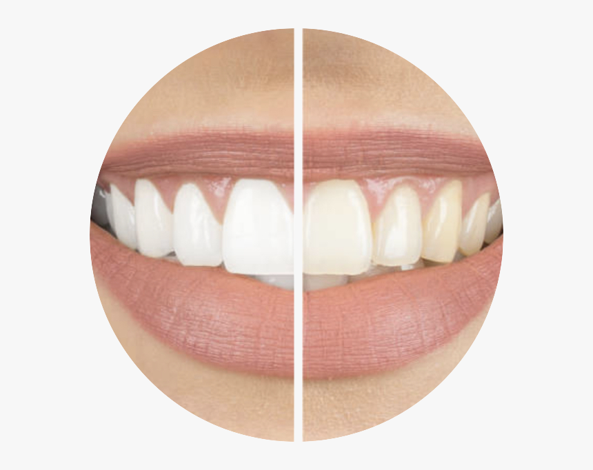 Gold Star Logos & Snippets - Zähne Bleaching, HD Png Download