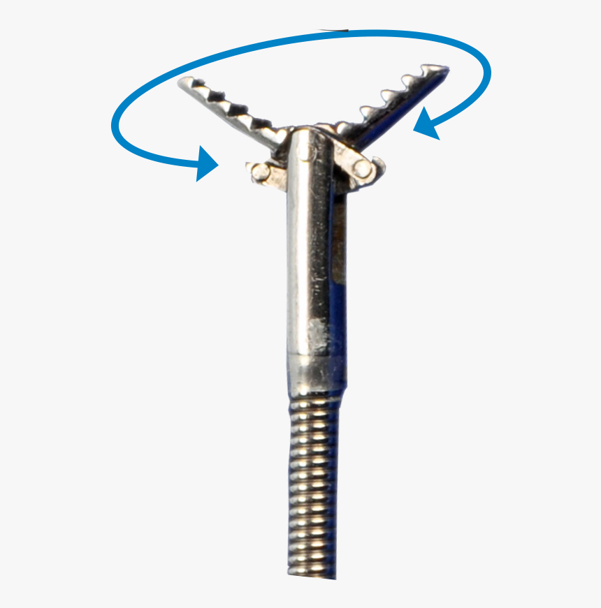 Foreign Body Loop Shaili Endoscopy, HD Png Download