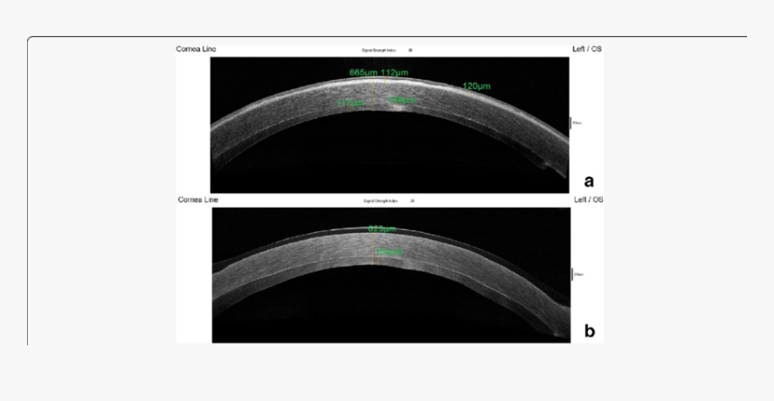 Screenshot, HD Png Download