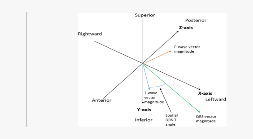 Superior Axis P Wave, HD Png Download