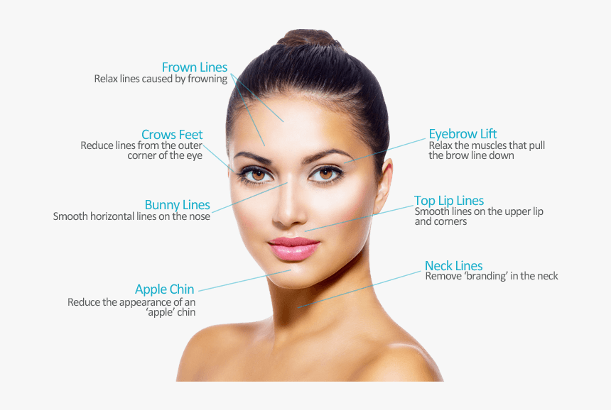 Botox Areas - Facial Aesthetics, HD Png Download