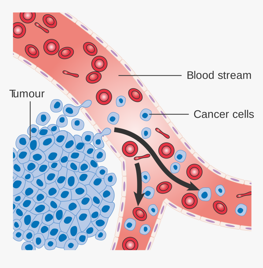 Do Cancer Cells Spread, HD Png Download