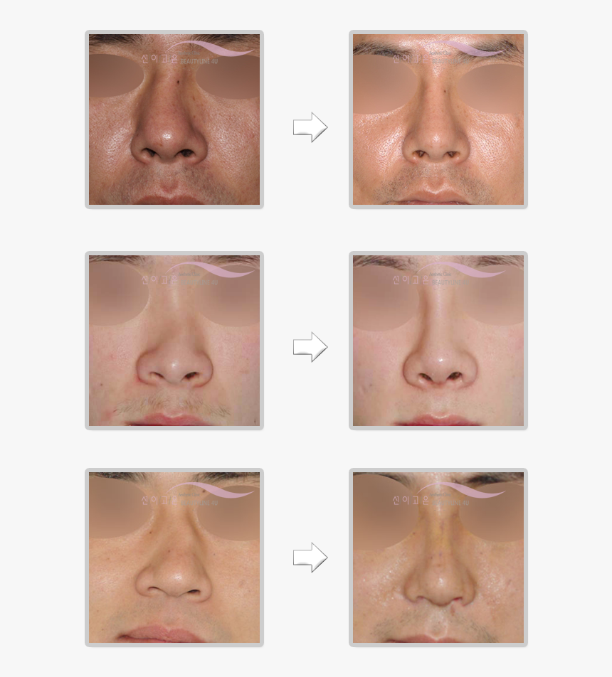 Bronze, HD Png Download