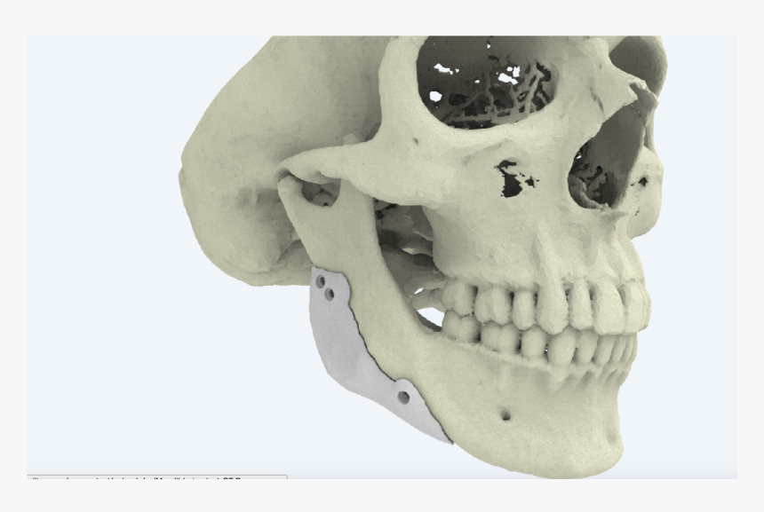 3d Printed Bones Skull, HD Png Download