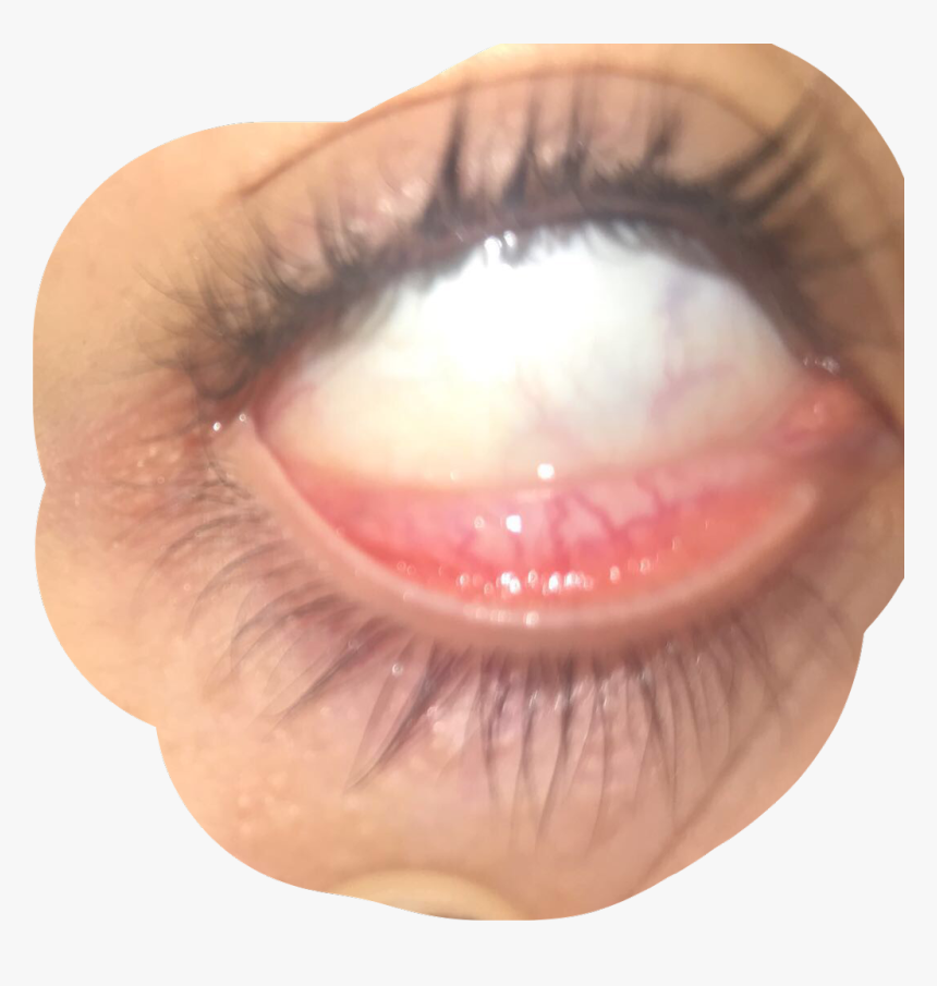 #eye #veins #goth #freetoedit - Close-up, HD Png Download