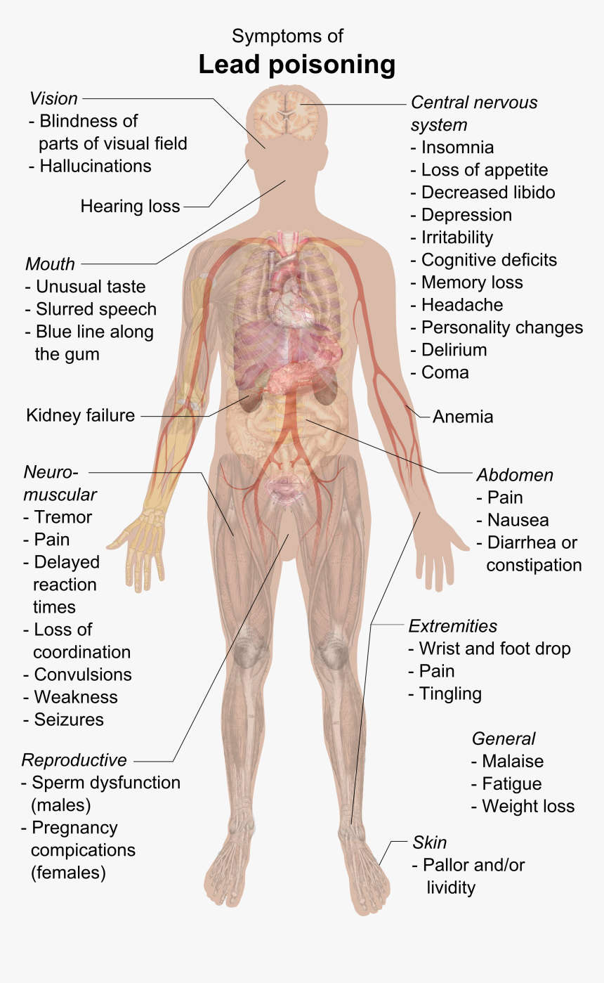 Symptoms Of Lead Poisoning - Lead Poisoning Symptoms, HD Png Download