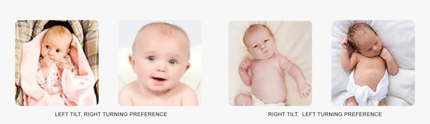 Headposturepreferences3 - Baby, HD Png Download