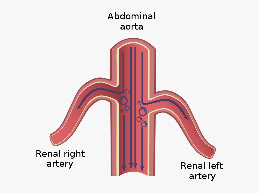 Turbulence In Abdominal Aorta Aneurisma - Aorta Addominale E Arteria Renale, HD Png Download