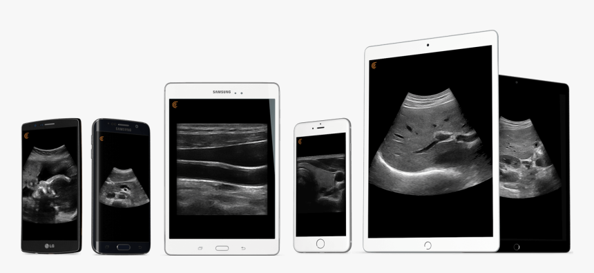 Smartphone, HD Png Download