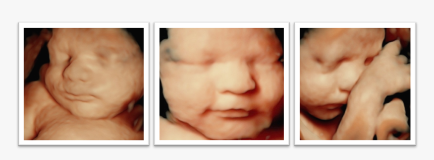 Ultrasound Photos - 4d Hd Ultrasound, HD Png Download