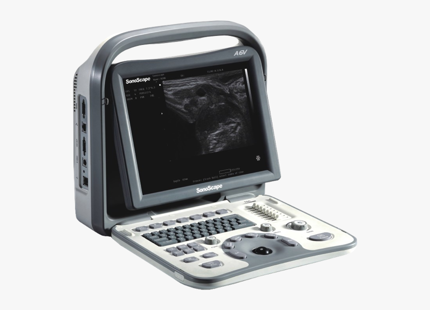 Sonoscape A6, HD Png Download