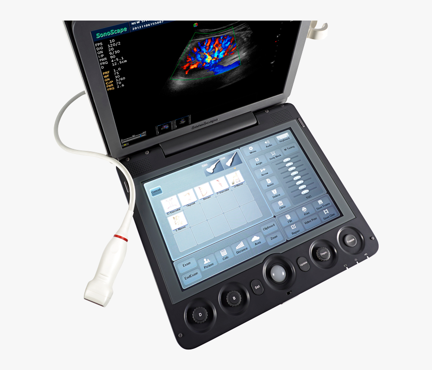 Sonoscape S9, HD Png Download