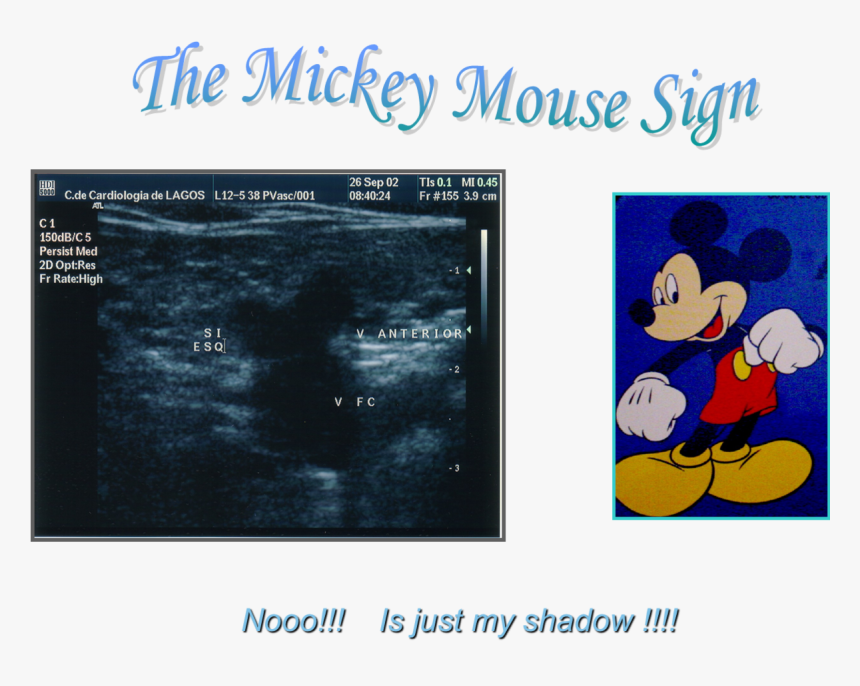 Transparent Mickey Mouse Symbol Png - Mickey Mouse Sign Doppler, Png Download