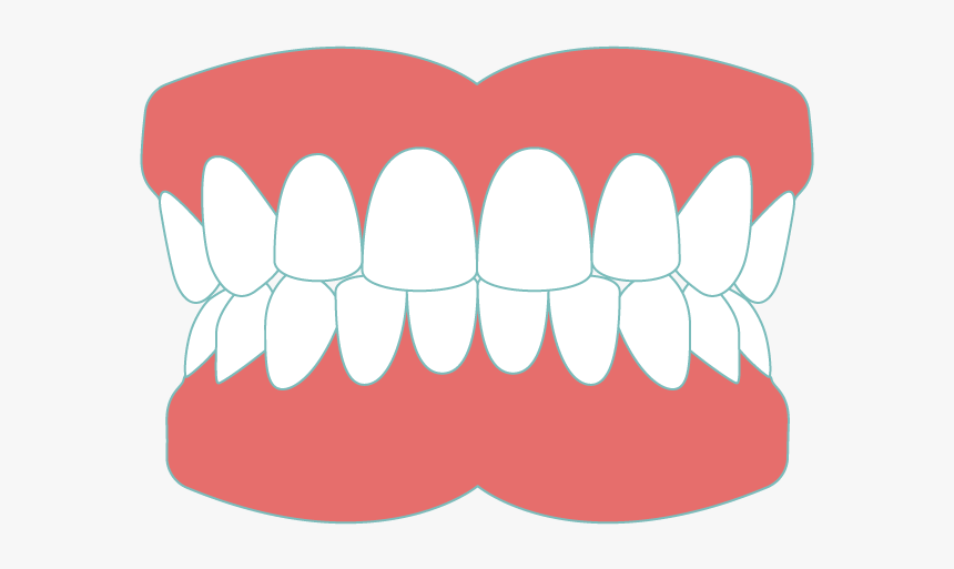 Dentures Sudbury, HD Png Download