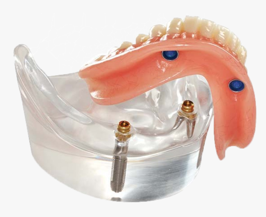 Stabilize Your Dentures And Regain Bite Strength, HD Png Download