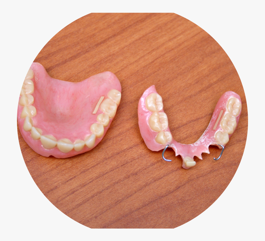 Dentures - Részleges Protézis, HD Png Download
