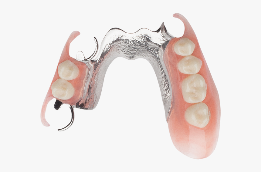 Single Dental Implant 1 - Dentistry, HD Png Download