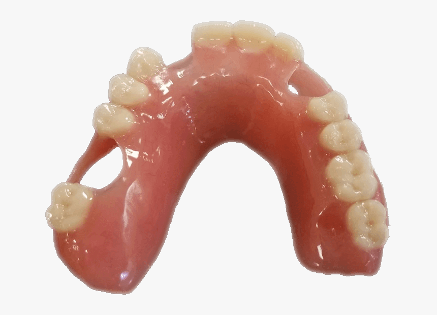 Acrylic Denture, HD Png Download