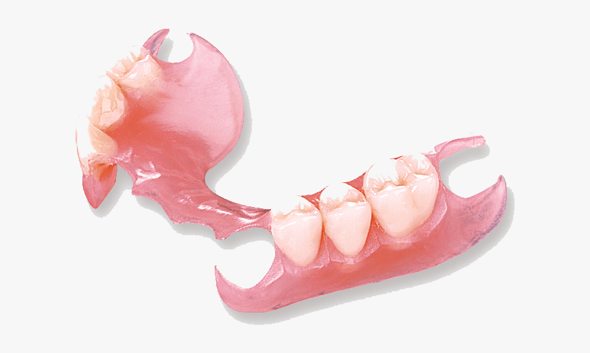 Flexi Partial Denture, HD Png Download