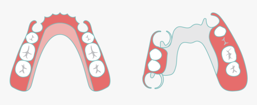 Partial Denture Sudbury Smiles, HD Png Download