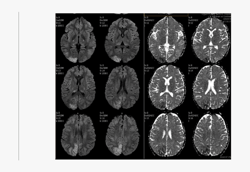 Circle, HD Png Download