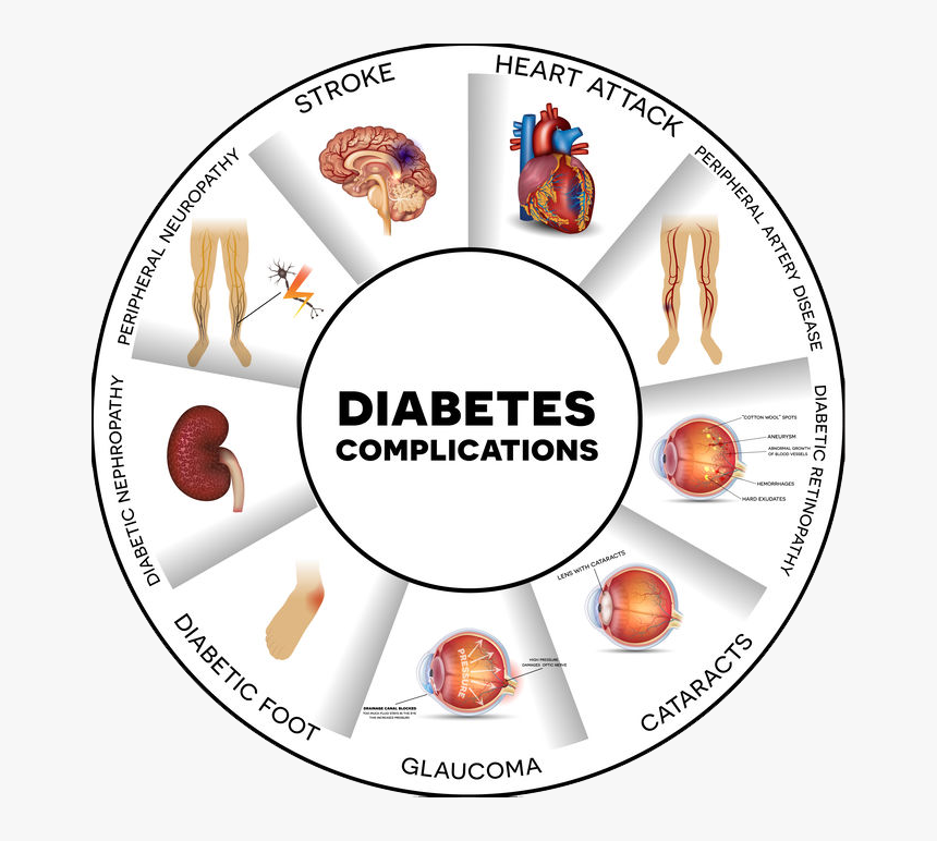 48739704 S - Complications Of Diabetes Poster, HD Png Download