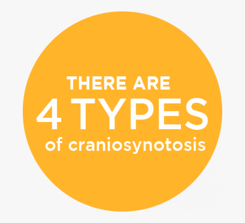 Craniosynostosis, HD Png Download